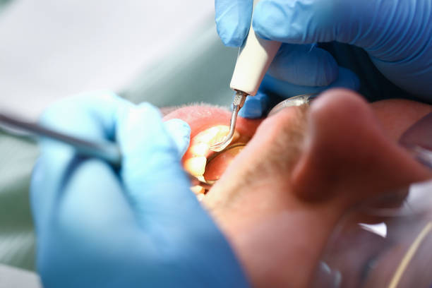 Best Emergency Treatment for Dental Infections or Abscesses in Fruitland, MD