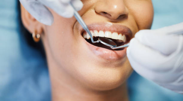 Best Emergency Tooth Extraction in Fruitland, MD