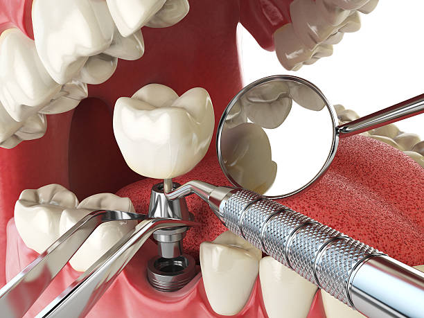 Best Cosmetic Emergency Dentistry in Fruitland, MD