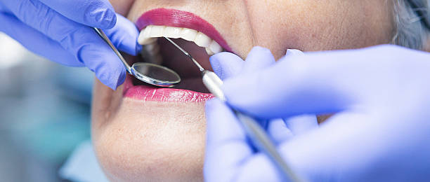Best Emergency Gum Treatment in Fruitland, MD